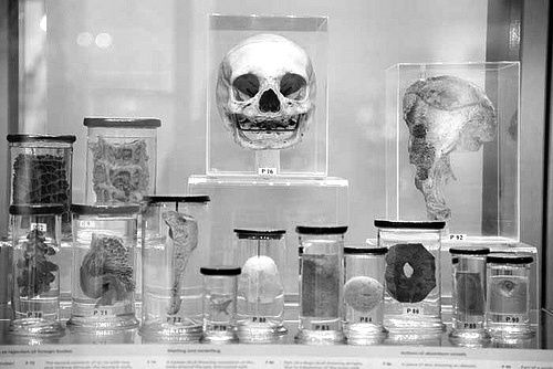 Präparate im Hunterian Museum; zur Verfügung gestellt von Joanna Ebenstein/www.astropop.com