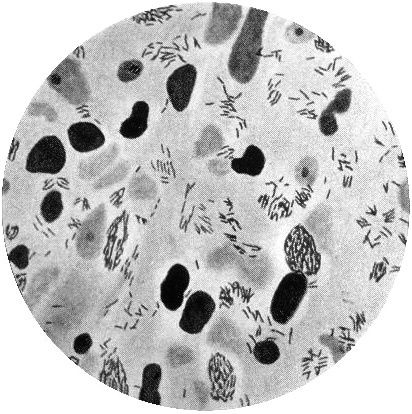 Mycobacterium leprae