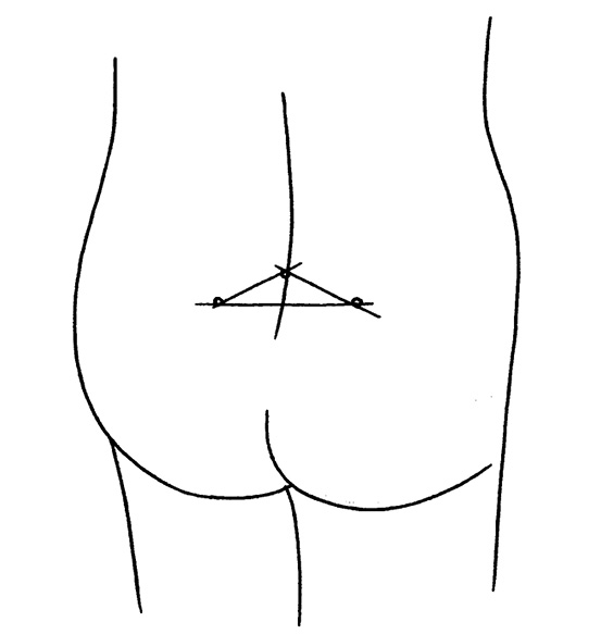 102_Luna_Yoga.tif